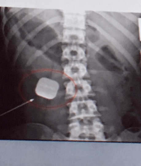 Screen Shot 2016-08-01 at 14.25.50.png 屏幕截图2016-08-01,14.25.50.png